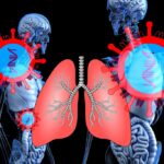 Lung cancer | Health care | Medicine