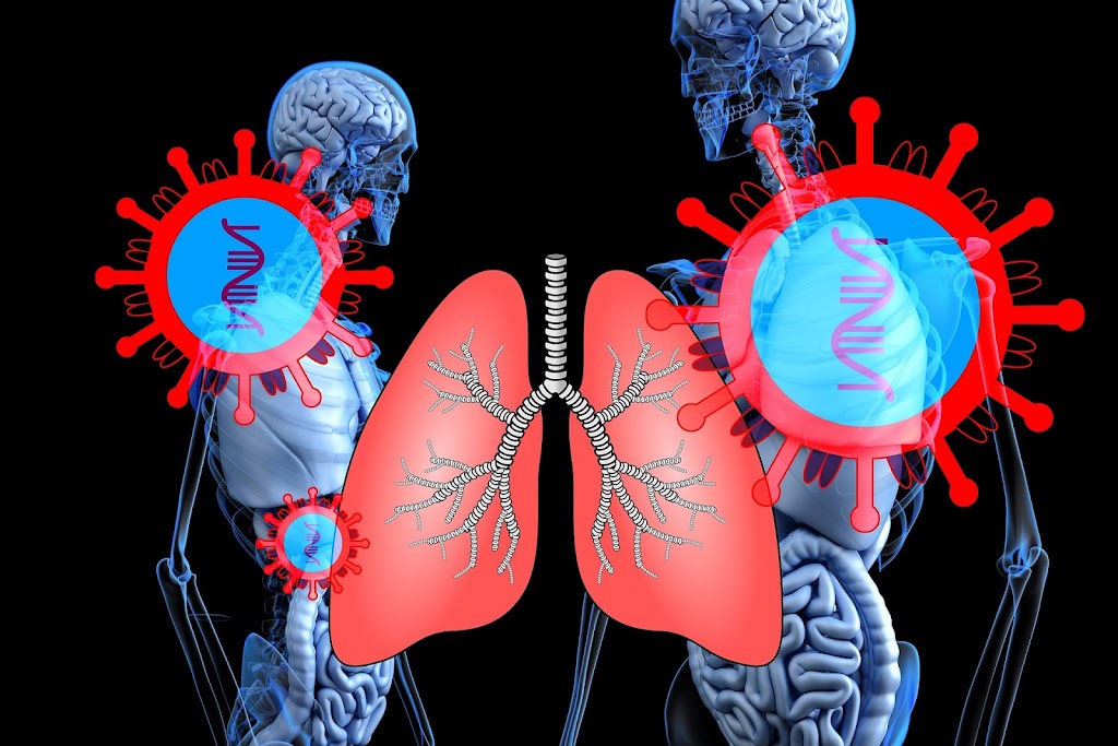 Lung cancer | Health care | Medicine